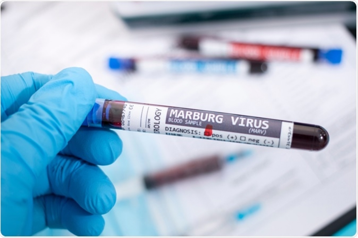 La Guinée déclare la fin de la flambée de maladie à virus Marburg