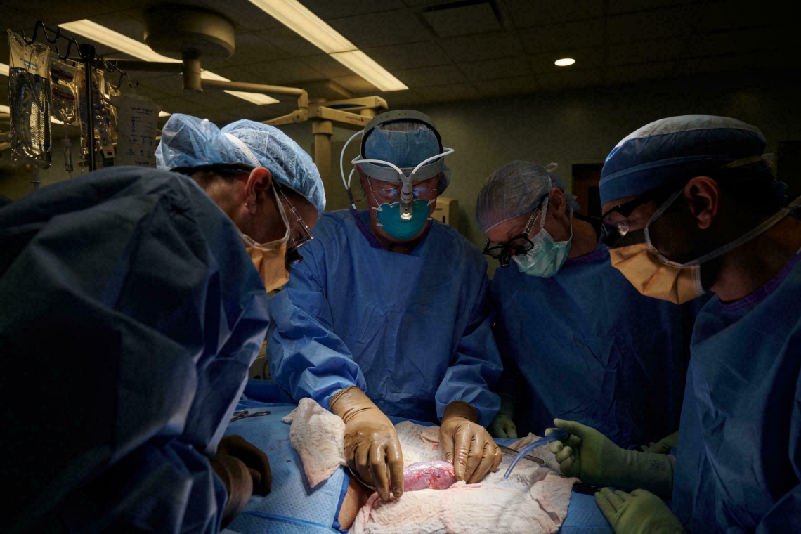 Révolution médicale : transplantation réussie d'un rein de porc sur un humain