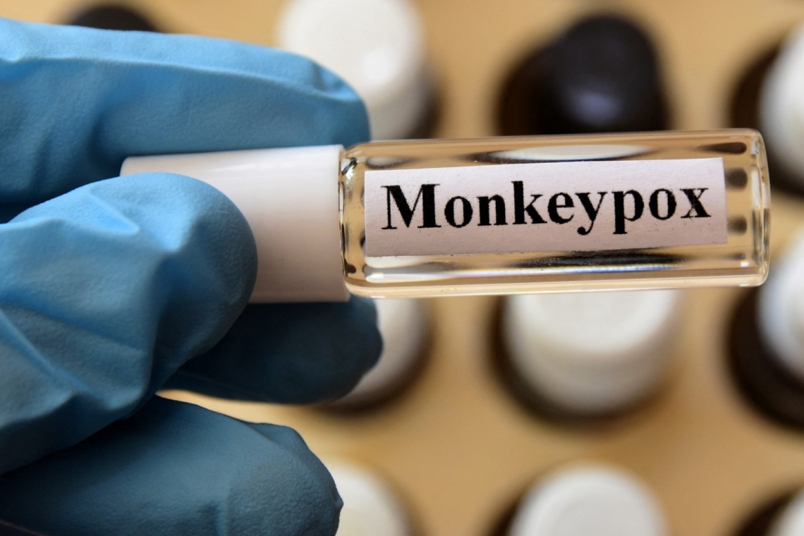 Décès d'un homme contaminé par la variole du singe en Inde, le premier cas recensé en Asie