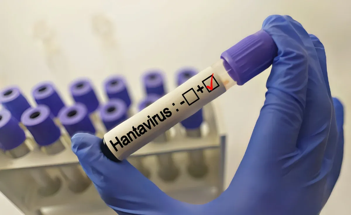 hantavirus-existe-t-il-un-traitement.webp
