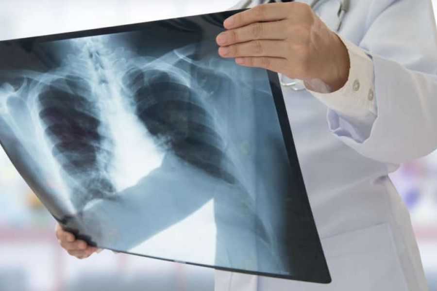 Maladies infectieuses en 2025 – Entre progrès médicaux et menaces persistantes