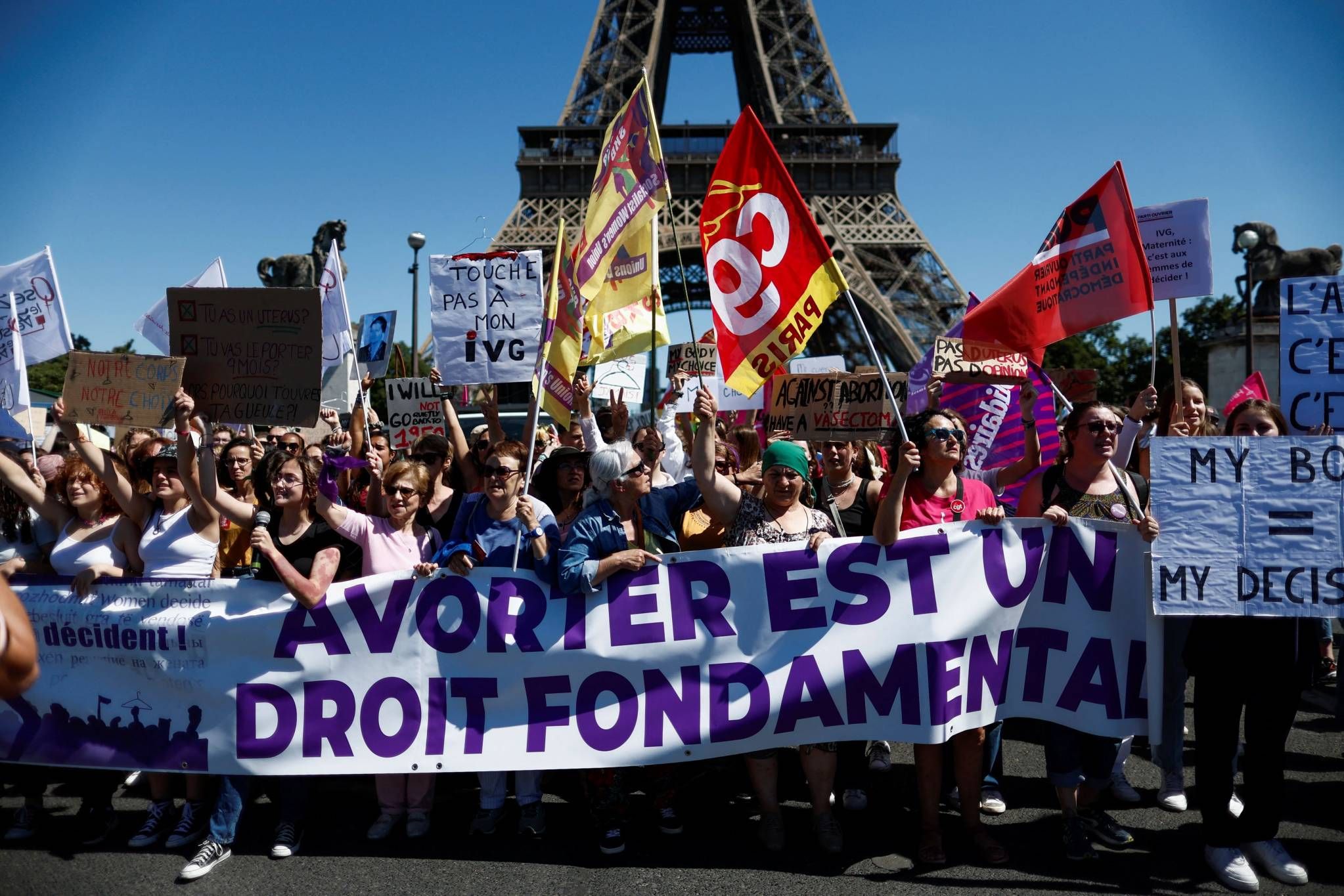 OMONDO SANTÉ - Avortement en France : Mobilisation massive pour défendre les droits reproductifs