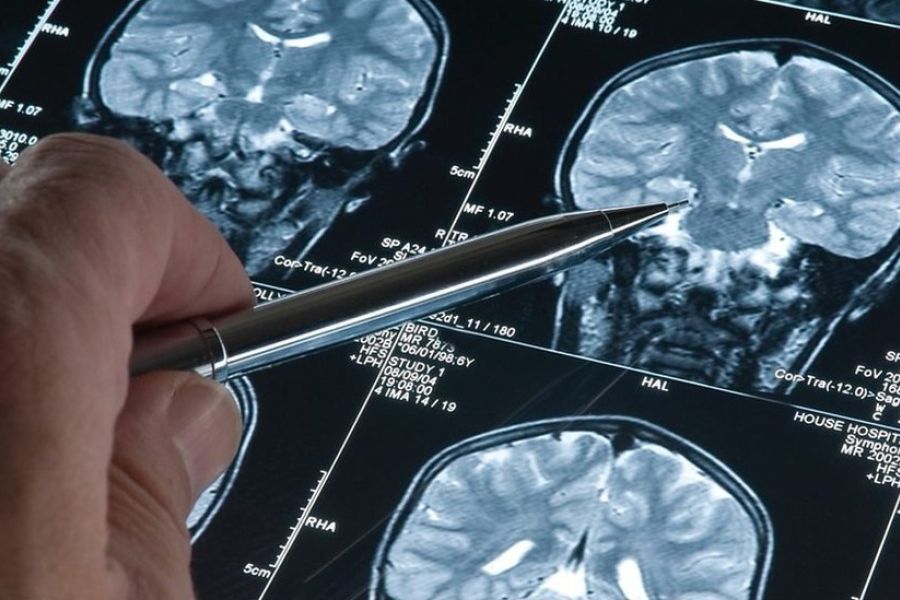 Santé Mondiale 2026 – L'Espoir Venu de Suisse : Une Percée Majeure Contre Alzheimer