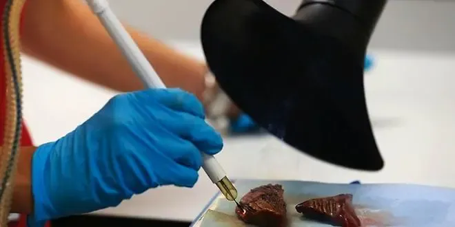 L'addictologie au bistouri se définit par une quête insatiable de correction pour des défauts souvent imaginaires ou microscopiques.