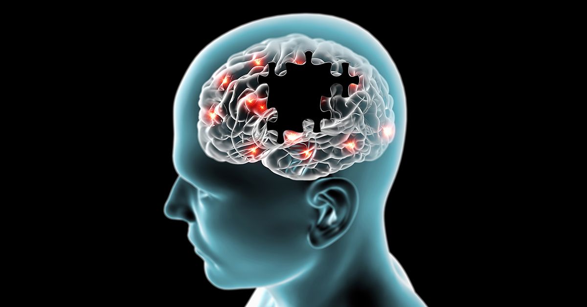 OMONDO TECH - IA : percée majeure dans la détection précoce des maladies neurodégénératives