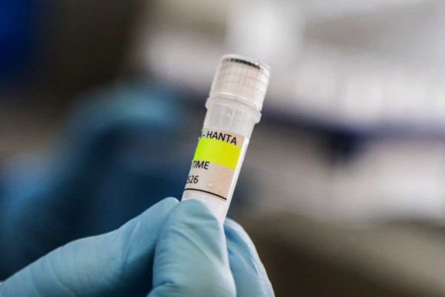 Recherche Institut Pasteur — Vers un vaccin universel contre les syndromes pulmonaires à Hantavirus ?